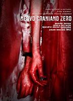 Nervo Craniano Zero (2012) Cenas de Nudez