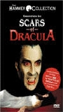 Scars of Dracula (1970) Cenas de Nudez